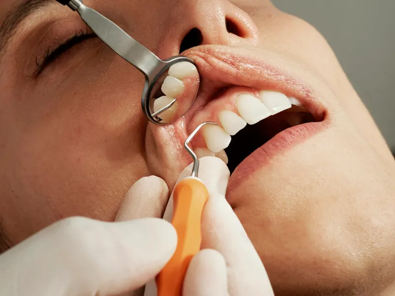Dental check-up and hygiene
